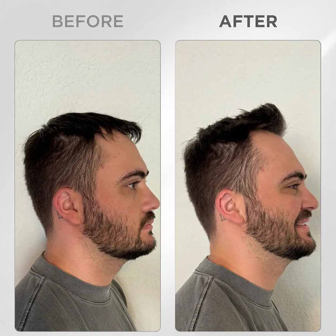  Before and after Balmain Styling Powder UAE men's hair volume and texture results