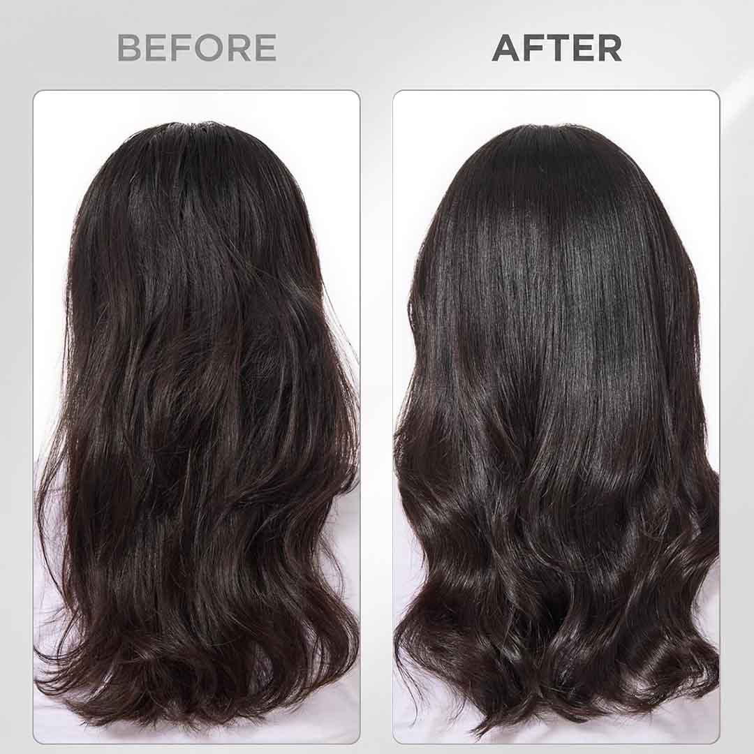 Before and after Vichy Dercos Advanced Shampoo UAE dandruff and itchy scalp results