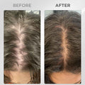 Scalp massager with hair growth serum enhanced absorption for UAE hair fall treatment